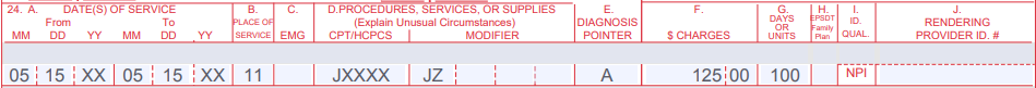 JZ modifier billing example