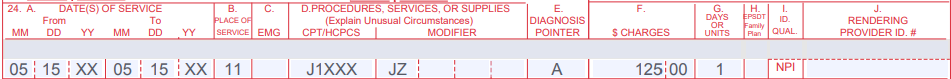 JZ modifier billing example 1